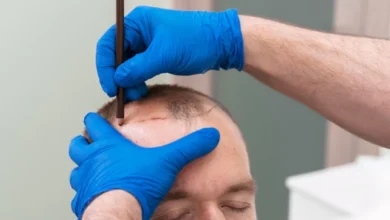 وظائف مستشارة زراعة شعر في السياحة العلاجية